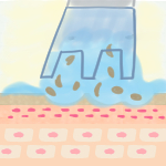 ハイドラフェイシャル